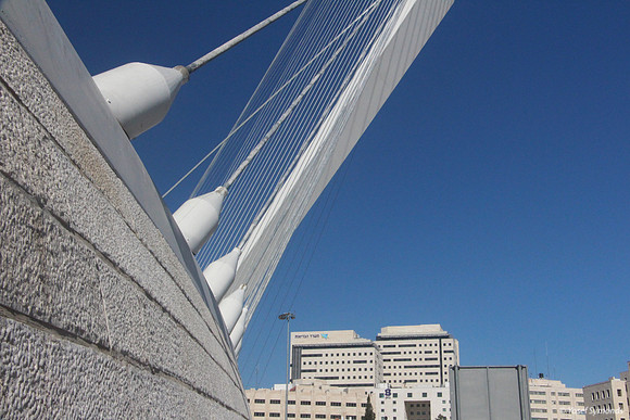 String Bridge 150201-1