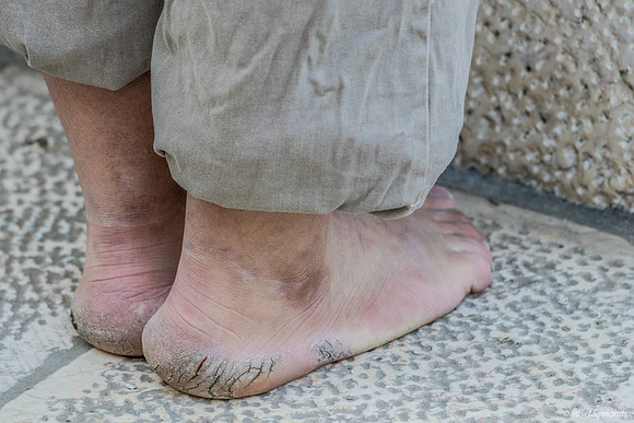 Feet 220109-2